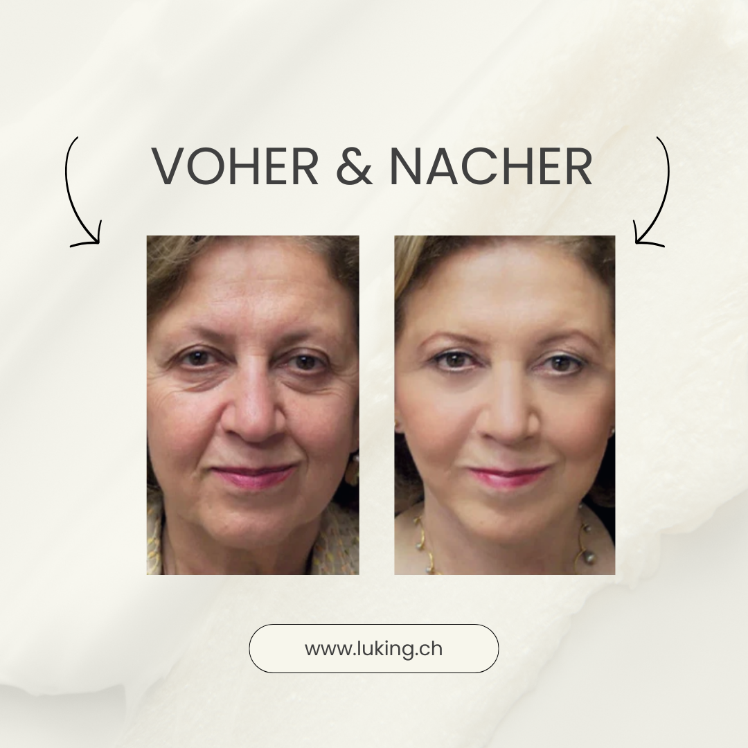 Luking Lifting Creme